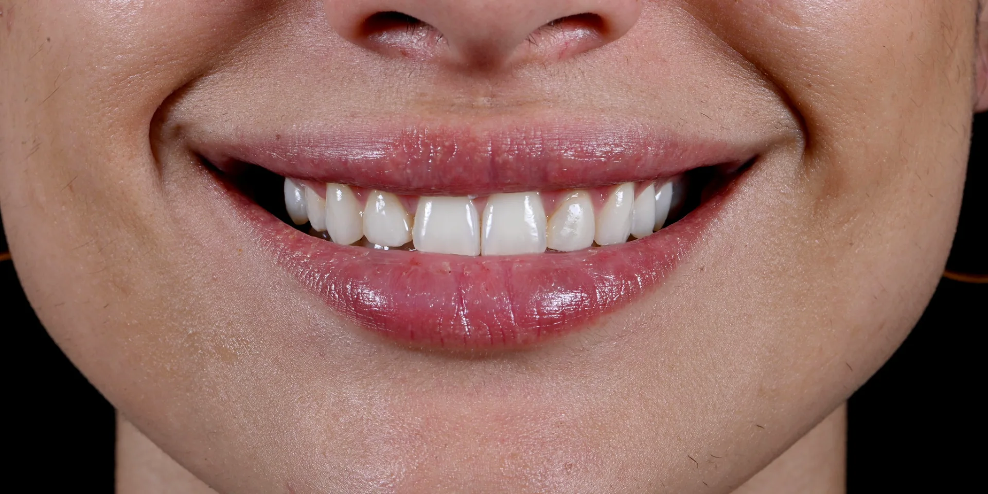 Cas patient — sourire