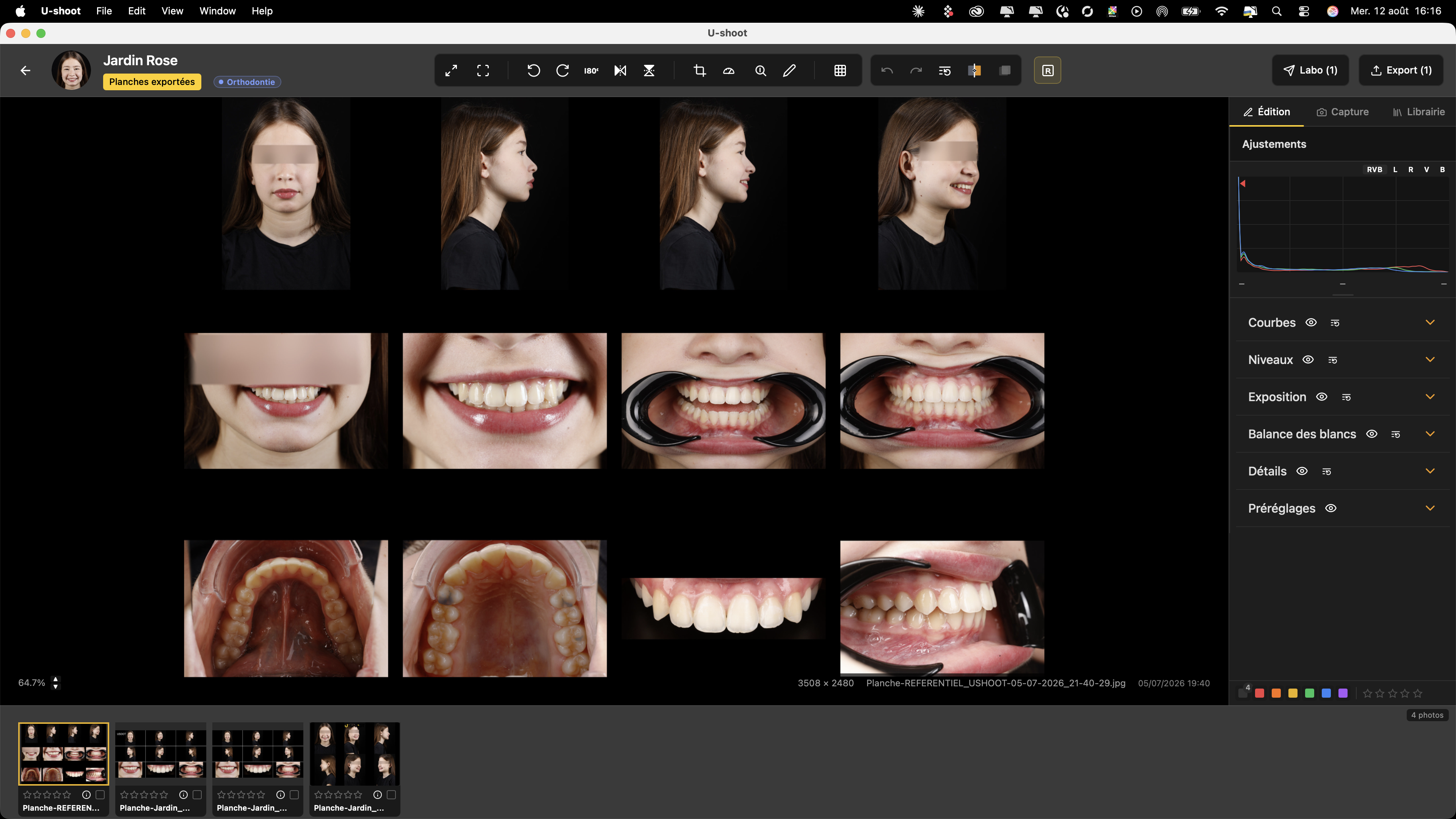 Logiciel U-SHOOT — planche contact du référentiel : portraits, sourires et vues intra-orales, yeux floutés, avec le panneau d'édition à droite.
